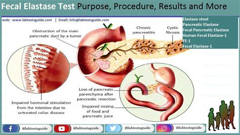 elastaza pancreatica in materii fecale|The role of fecal elastase